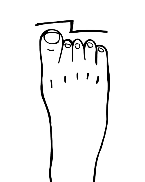 block image