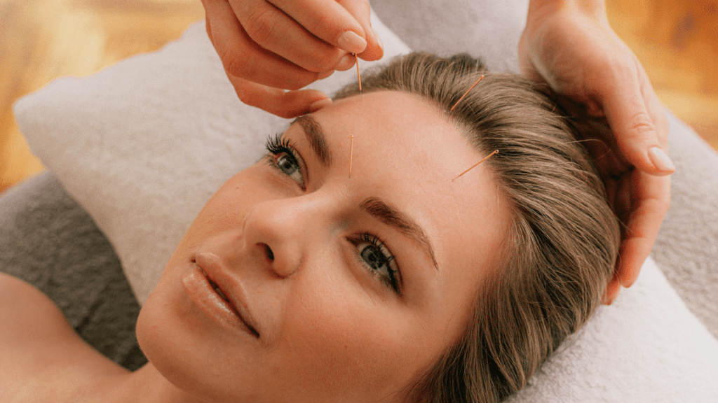 Gesichtsakupunktur | Treatwell